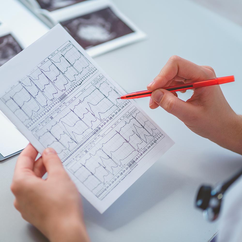 Kardiologische Diagnostik Berlin